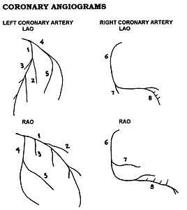 IV Setup Diagram